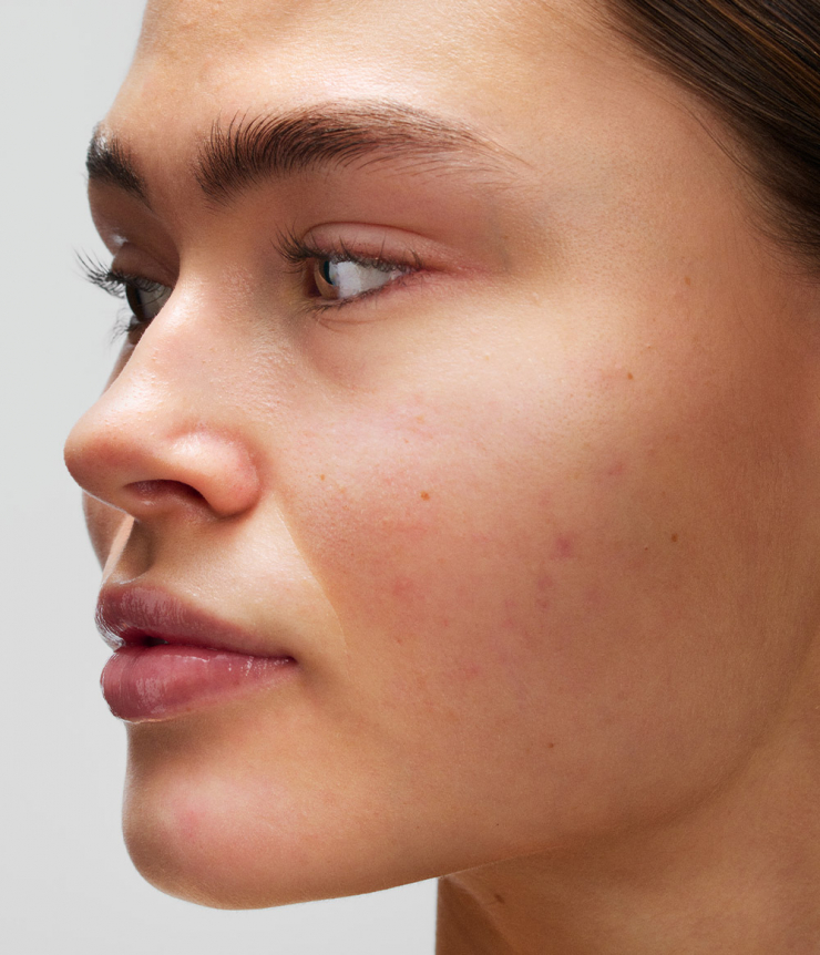 HYDRA MATTE FACE CREAM